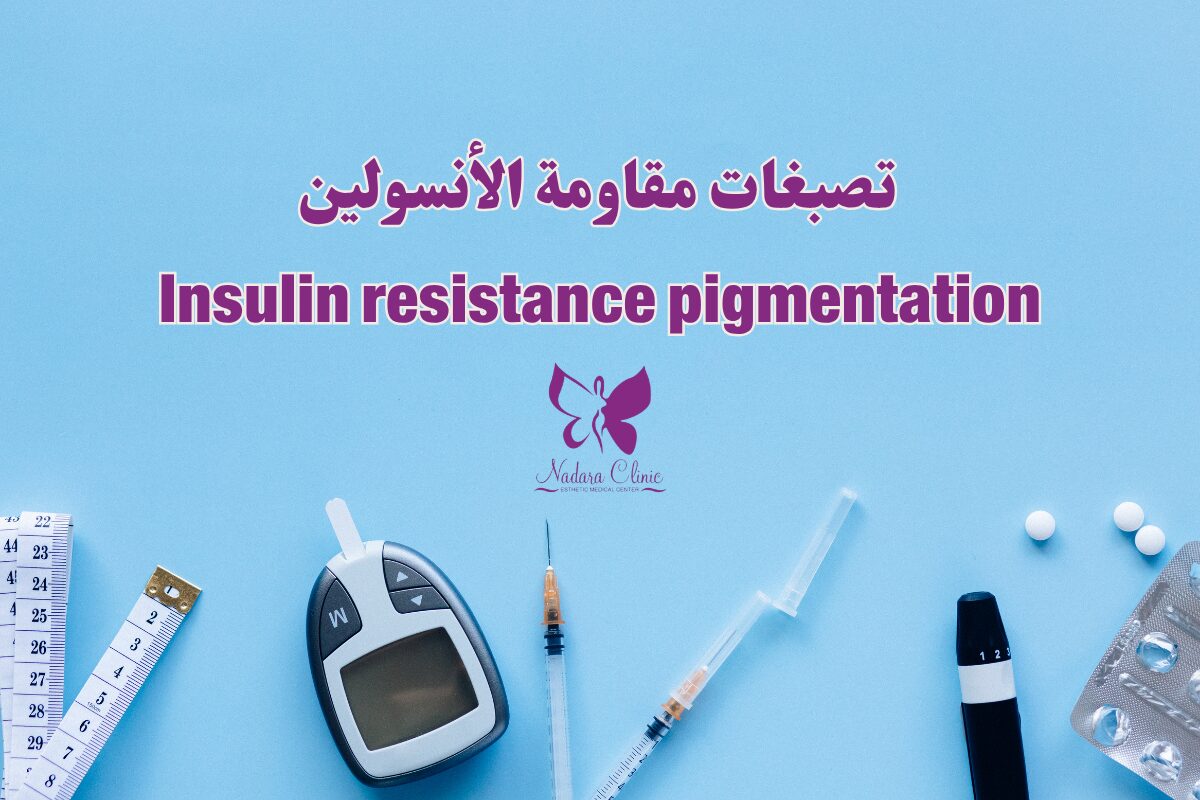 Insulin resistance pigmentation in Hurghada